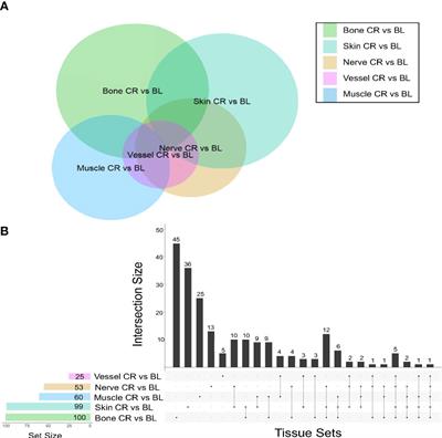 Peripheral nerve repair is associated with augmented cross-tissue inflammation following vascularized composite allotransplantation